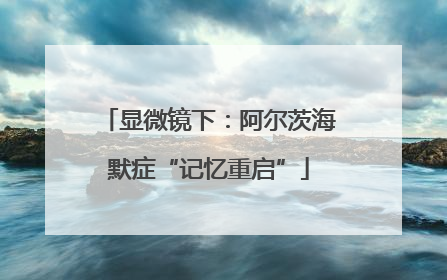 显微镜下：阿尔茨海默症“记忆重启”